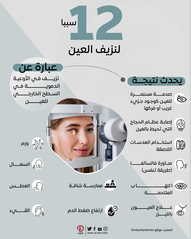 12 سببا لنزيف العين 