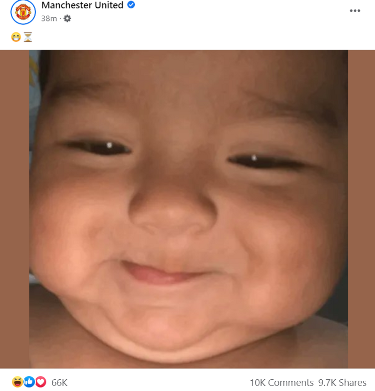 ابتسامة كاسيميرو البرازيلي كاسيميرو