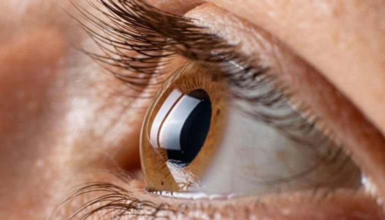 انفصال الشبكية يعد من أبرز أسباب الإصابة بالعمى- أرشيفية