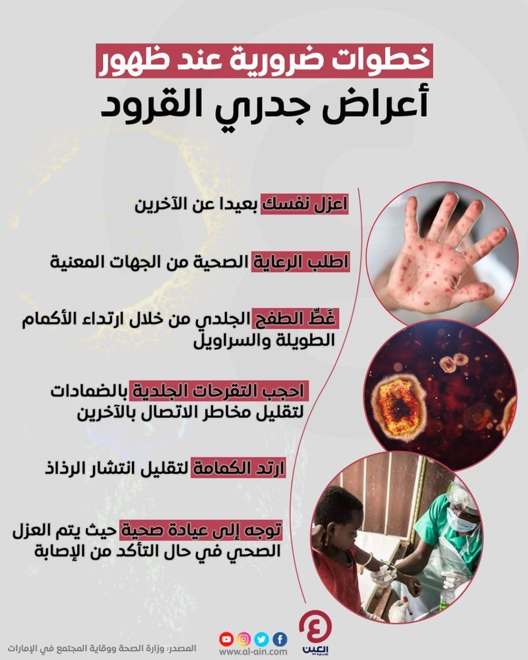 مريض مصاب بجدري القرود