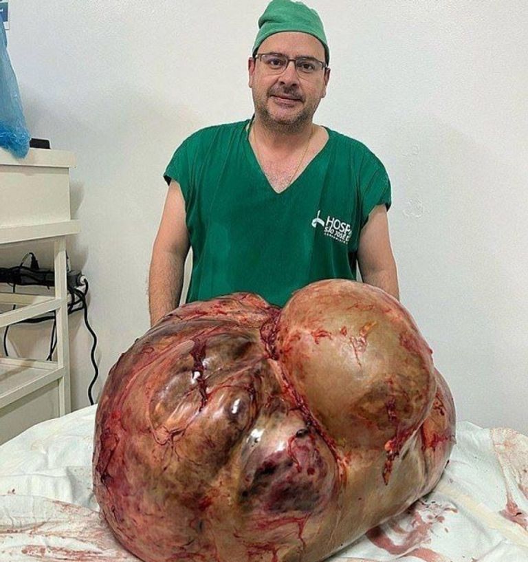 أطباء في عملية جراحية- أرشيفية