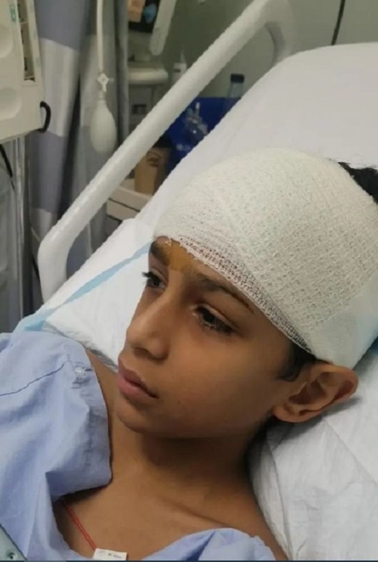 الطالب أسامة الغامدي المصاب بكسر في الجمجة داخل المستشفى الطالب أسامة الغامدي المصاب بكسر في الجمجة داخل المستشفى