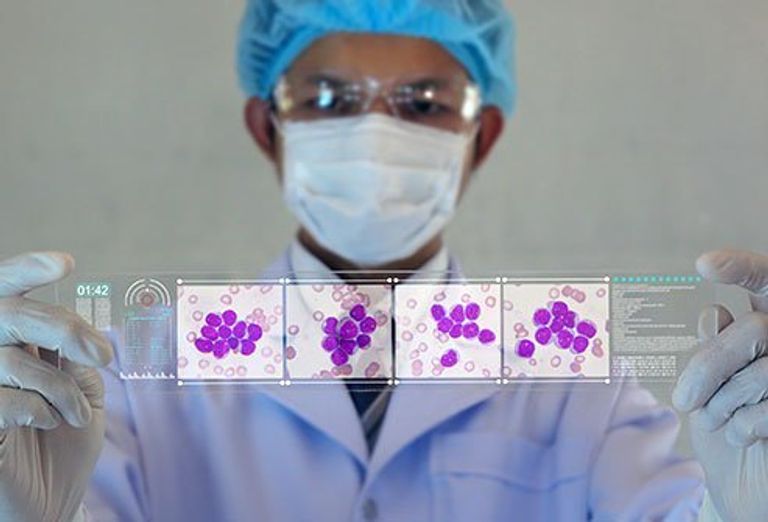 خلايا سرطانية في الدم- أرشيفية