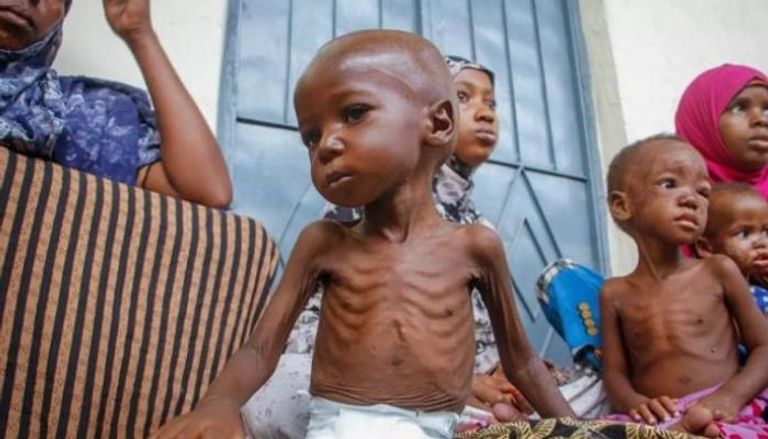 المجاعة تضرب أطفال الصومال بقسوة