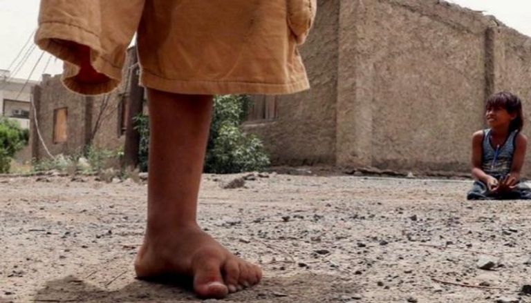 الألغام تشوه أطفال اليمن- أرشيفية