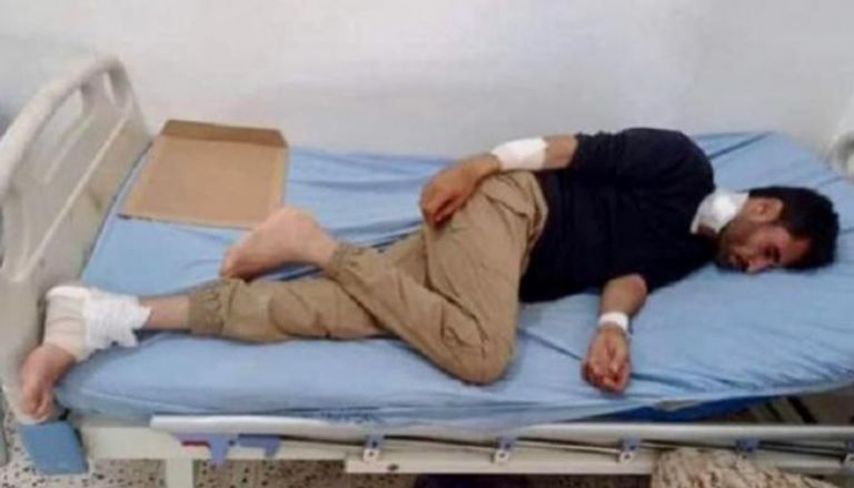 أحد الضحايا بهجمات مليشيات الحوثي