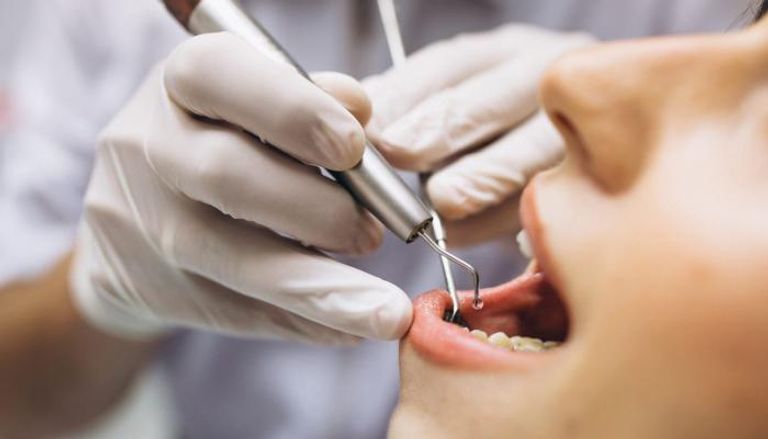 توصية لمرضى الحساسية بضرورة إخبار طبيب الأسنان بمرضهم