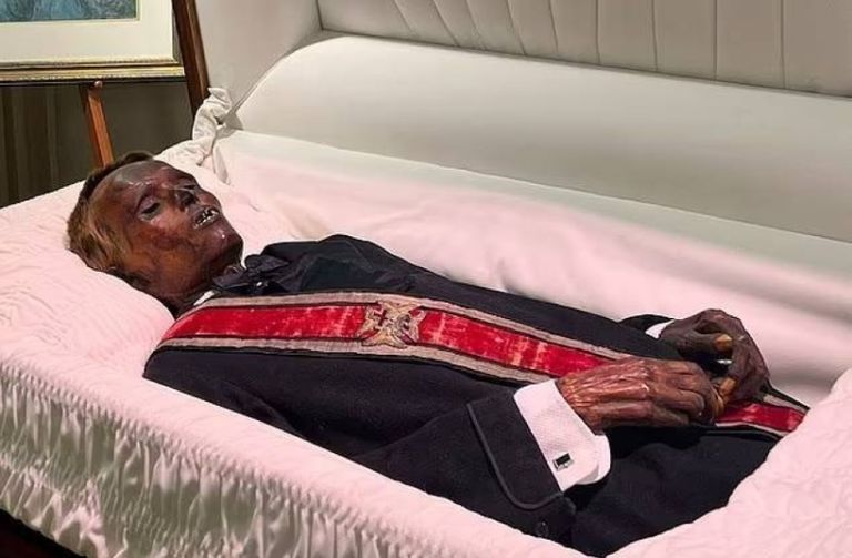 مومياء ستونمان ويلي