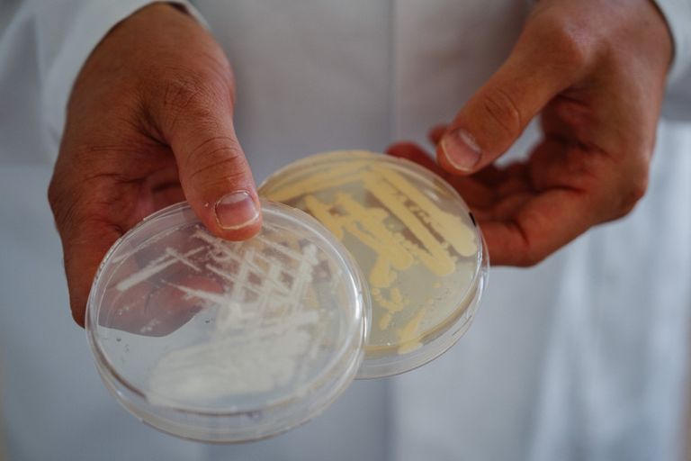 إنتاج بروتينات حليب أو بيض من دون استخدام الحيوانات