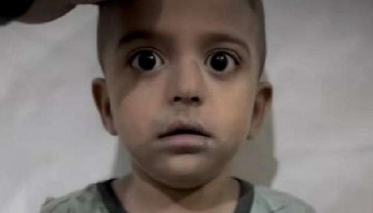 الطفل الفلسطيني محمد أبولولي