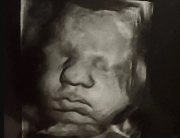 التوأم مع الأم والأب