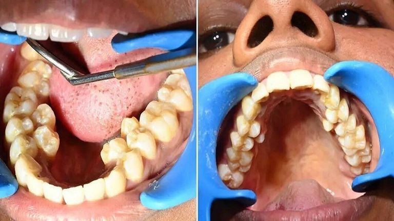 الهندية صاحبة الرقم القياسي