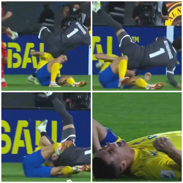 إصابة كريستيانو رونالدو كريستيانو رونالدو قائد النصر السعودي