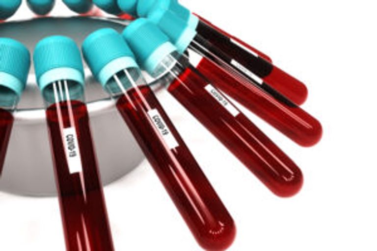 الكشف عن الميول الانتحارية باختبار دم