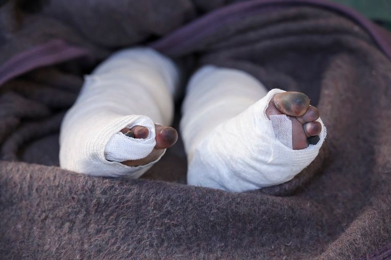 الطفلة السورية شام