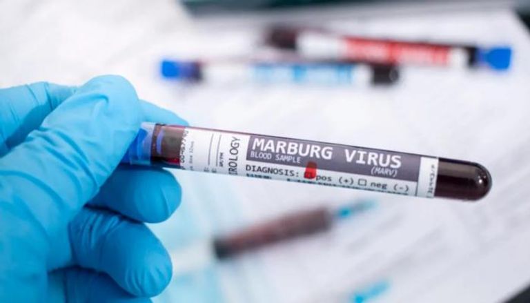 السلطات الإسبانية ترصد أول إصابة مشتبه بها بفيروس ماربورغ- أرشيفية