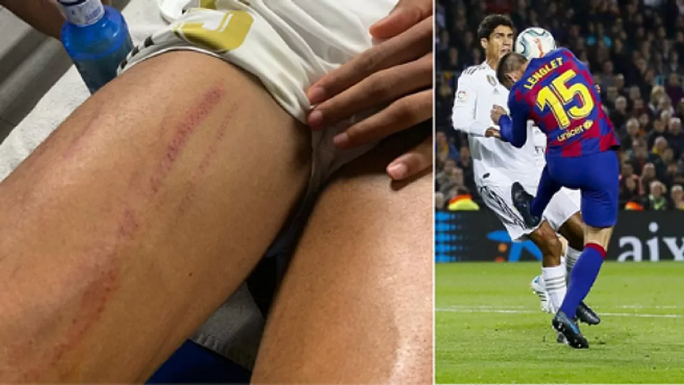 تقنية الفيديو