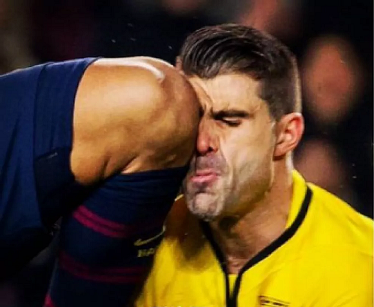 ركبة سواريز تقنية الفيديو