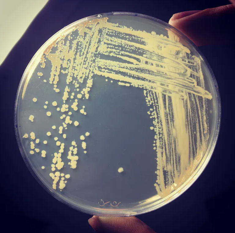  بكتيريا " المتفطرة اللخنية "