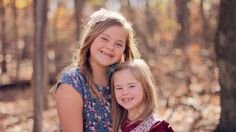 أطفال مصابون بمتلازمة داون