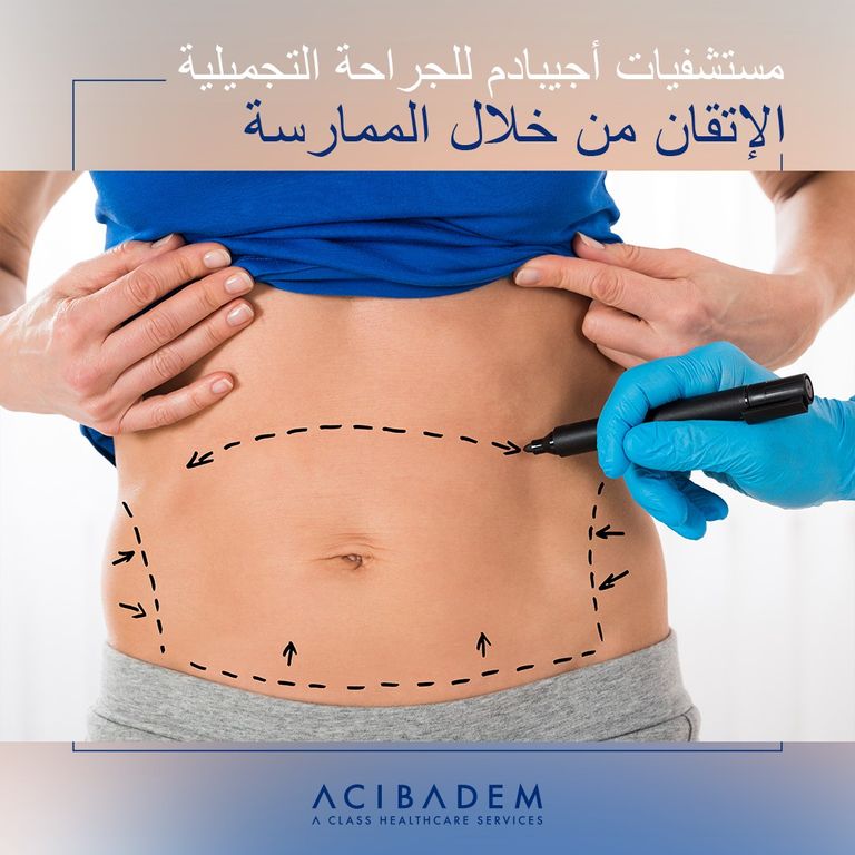 مستشفيات أجيبادم في تركيا