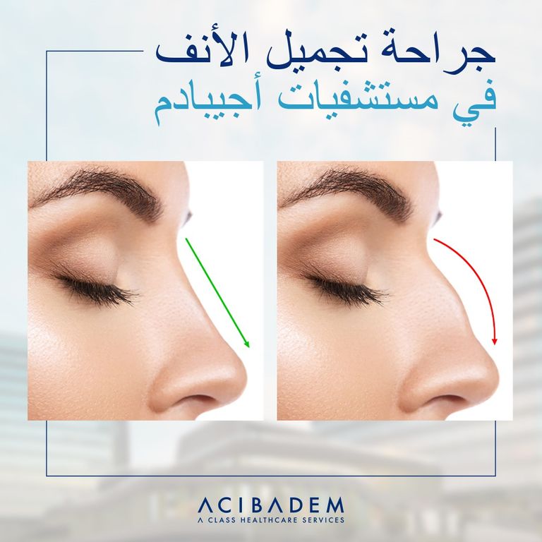 مستشفيات أجيبادم في تركيا