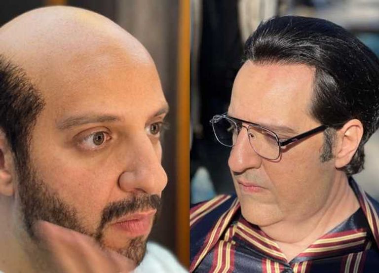 أحمد أمين على ملصق مسلسل