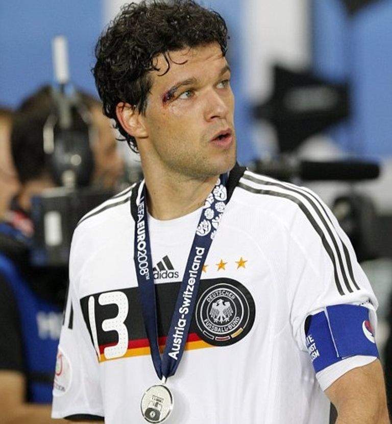 بالاك مع فضية يورو 2008