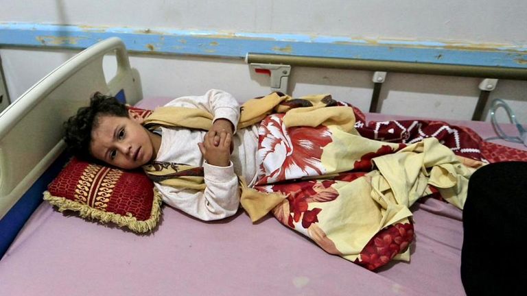 طبيبة تفحص طفلا في اليمن