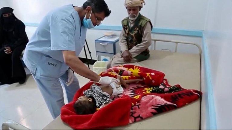 طبيبة تفحص طفلا في اليمن