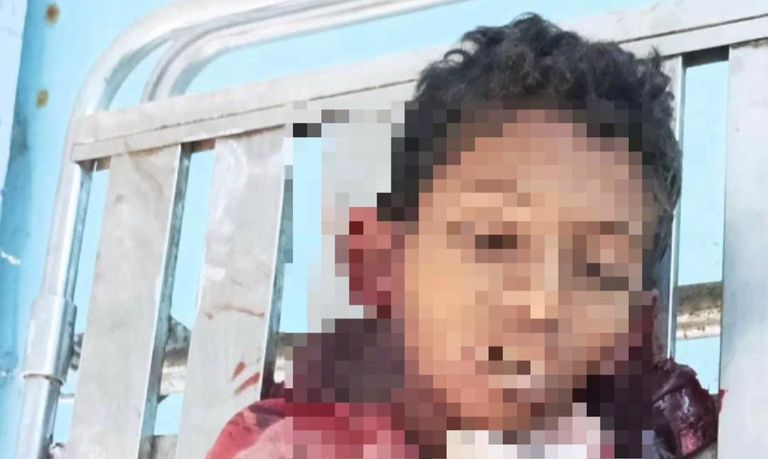 جهاد حيمي.. أحدث ضحايا طائرات الحوثي المسيرة عناصر مليشيات الحوثي الإرهابية - أرشيفية