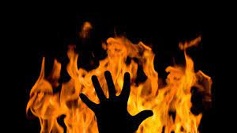 سيدة تشعل النار في زوجة ابنها بالعراق- أرشيفية