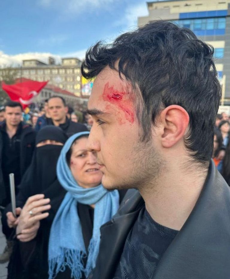 مصاب جراء اعتداء بالحجارة على مؤتمر انتخابي للمعارضة التركية إمام أوغلو بعد تعرضه لهجوم بالحجارة