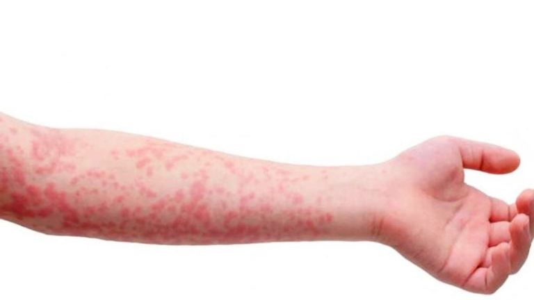 اختبارات طبية- أرشيفية