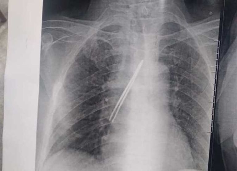 غرفة عمليات- أرشيفية