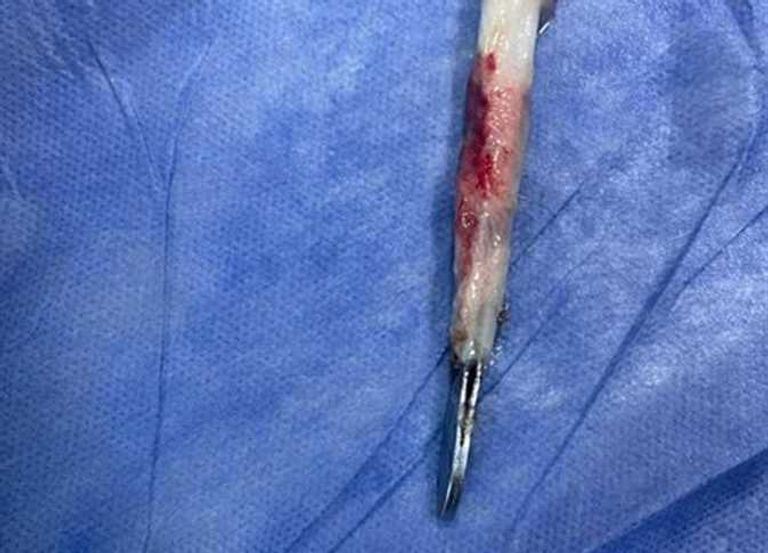 غرفة عمليات- أرشيفية