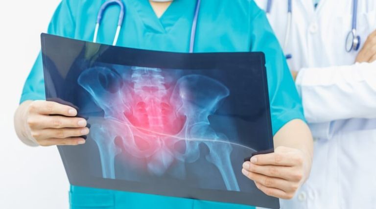 بروفيسور "ينقذ عظام فتاة من السرطان".. طفرة في تقنيات بناء الأطراف 4
