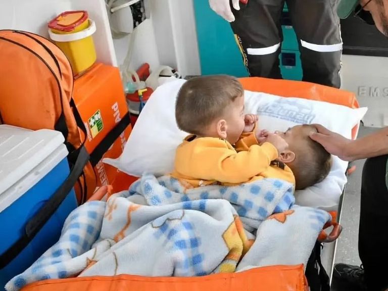 التوأم السيامي السوري بسام وإحسان