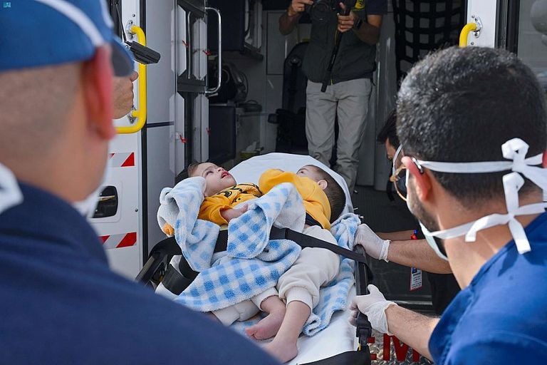 التوأم السيامي السوري بسام وإحسان