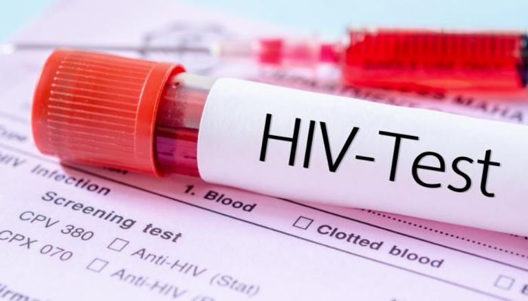 الإيدز عدوى تهاجم جهاز المناعة في الجسم