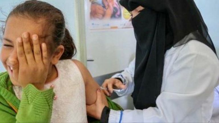 رضيعة يمنية تعاني من المرض - أرشيفية