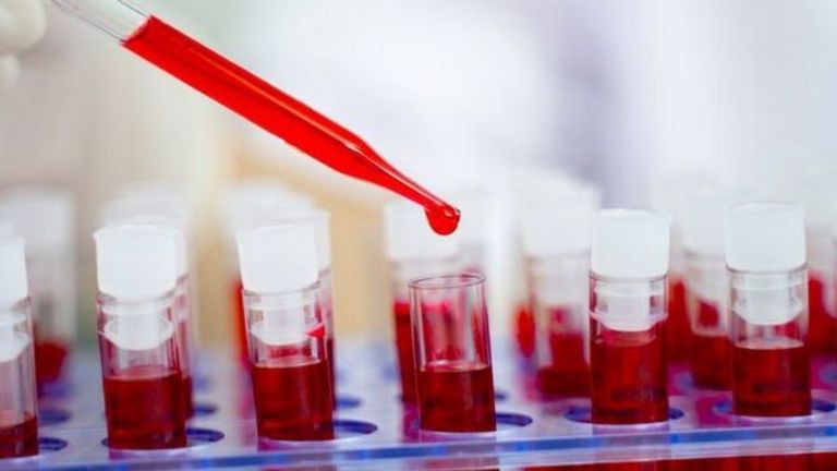 العديد من التجارب السابقة الساعية للوصول إلى لقاح باءت بالفشل