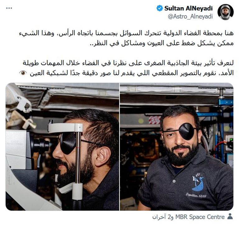سلطان النيادي يجري فحصا لعينيه في محطة الفضاء الدولية