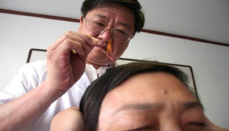 الإبر من أشهر أدوات الطب البديل في الصين