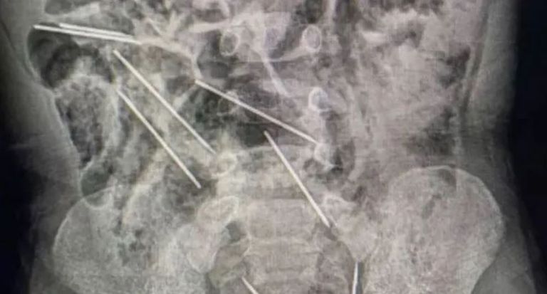 إبر حقن- أرشيفية