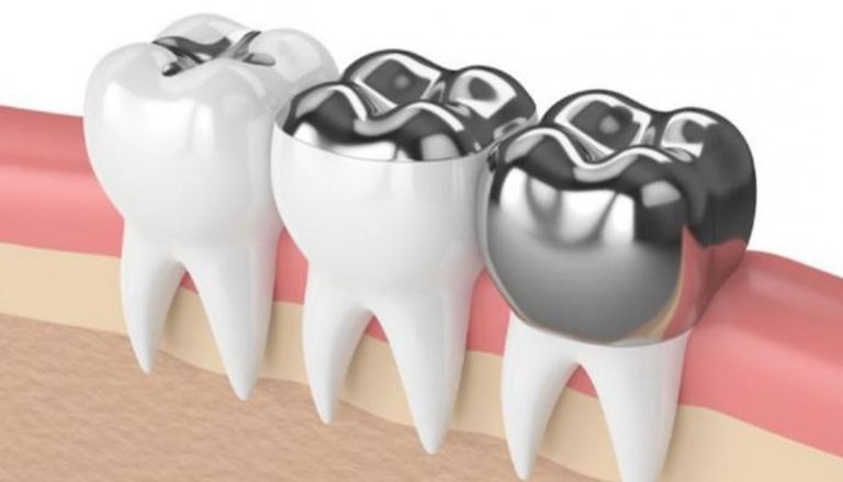 استخدام الزئبق في حشوات الأسنان يسبب أضراراً بالغة