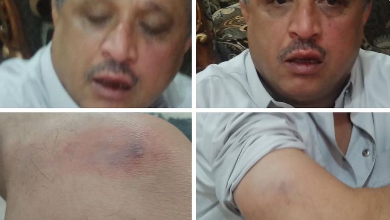 القاضي قطران الذي اعتقله الحوثيون اليوم