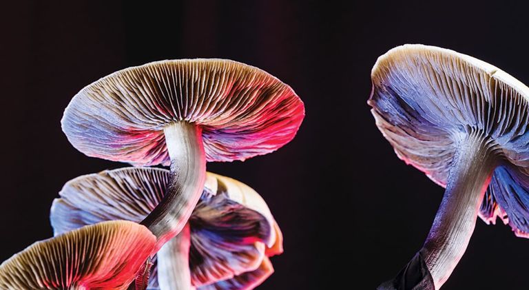 أشعة تكشف عن حالة دماغ شخص مصاب بأميبا الدماغ