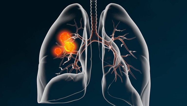 أجهزة الاستشعار النانوية