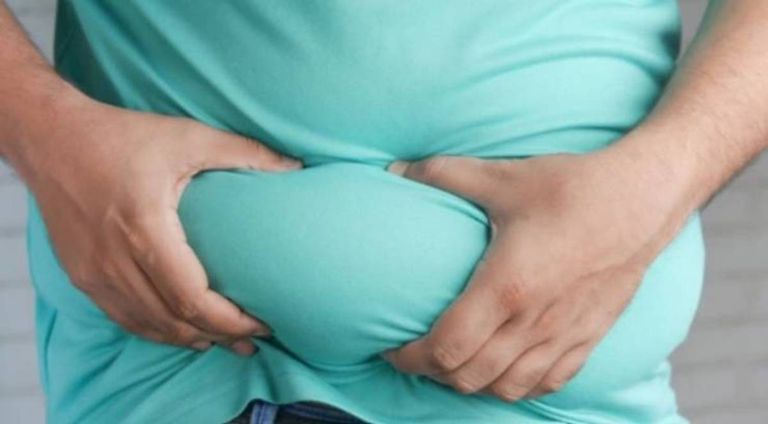 شخص يعاني من السمنة- أرشيفية